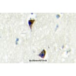 Anti-AR-α1A (Q365) Antibody from Bioworld Technology (BS2207) - Antibodies.com