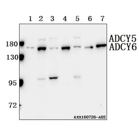 Anti-ADCY 5/6 (F1052) Antibody from Bioworld Technology (BS2208) - Antibodies.com