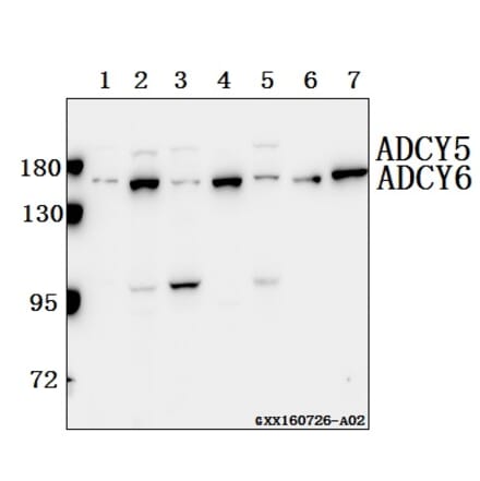 Anti-ADCY 5/6 (F1052) Antibody from Bioworld Technology (BS2208) - Antibodies.com