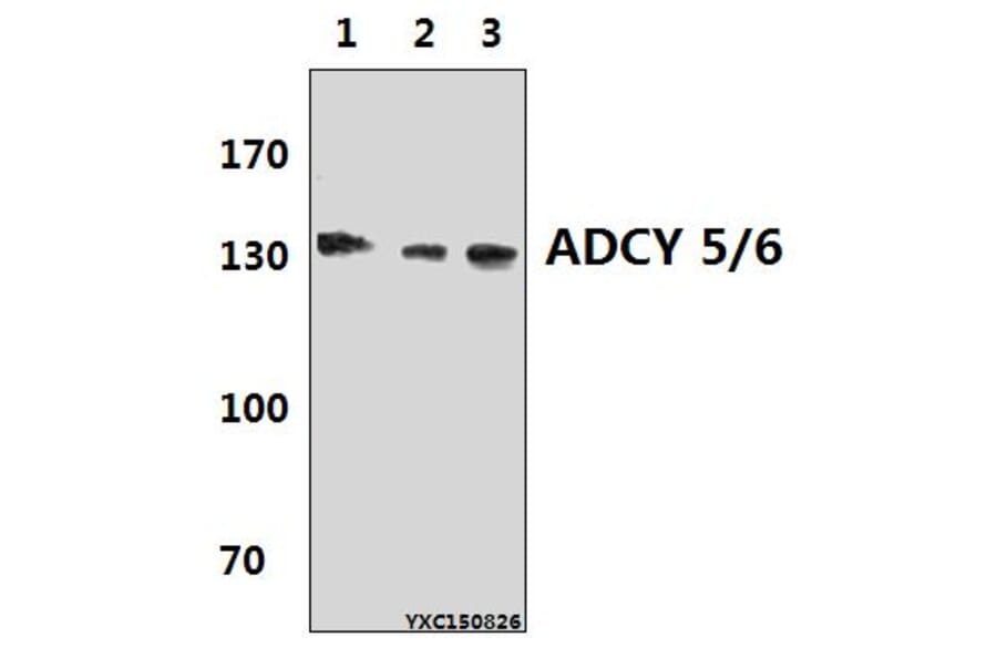 Anti-ADCY 5/6 (F1052) Antibody from Bioworld Technology (BS2208) - Antibodies.com