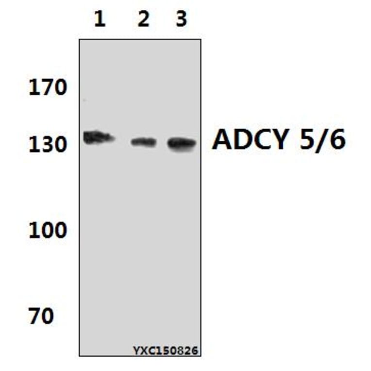 Anti-ADCY 5/6 (F1052) Antibody from Bioworld Technology (BS2208) - Antibodies.com