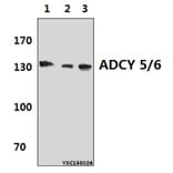 Anti-ADCY 5/6 (F1052) Antibody from Bioworld Technology (BS2208) - Antibodies.com