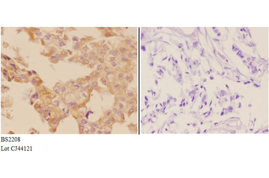 Anti-ADCY 5/6 (F1052) Antibody from Bioworld Technology (BS2208) - Antibodies.com