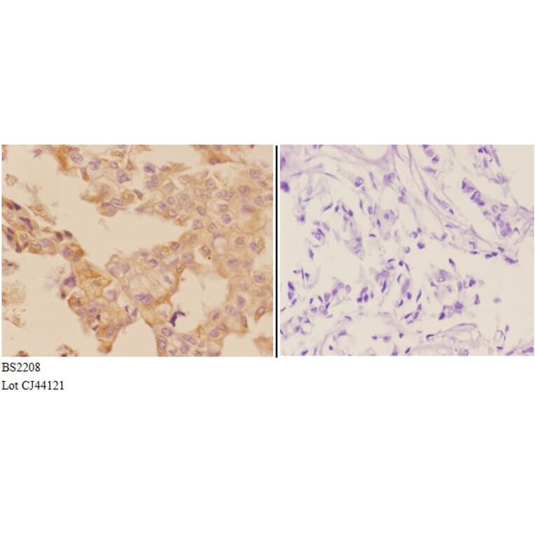 Anti-ADCY 5/6 (F1052) Antibody from Bioworld Technology (BS2208) - Antibodies.com