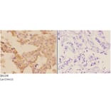 Anti-ADCY 5/6 (F1052) Antibody from Bioworld Technology (BS2208) - Antibodies.com