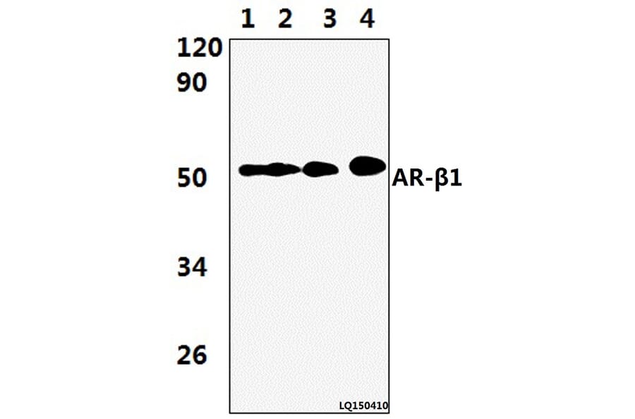 Anti-AR-β1 (A302) Antibody from Bioworld Technology (BS2210) - Antibodies.com