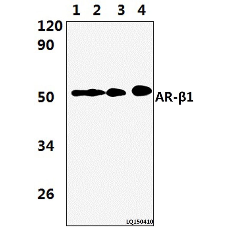 Anti-AR-β1 (A302) Antibody from Bioworld Technology (BS2210) - Antibodies.com
