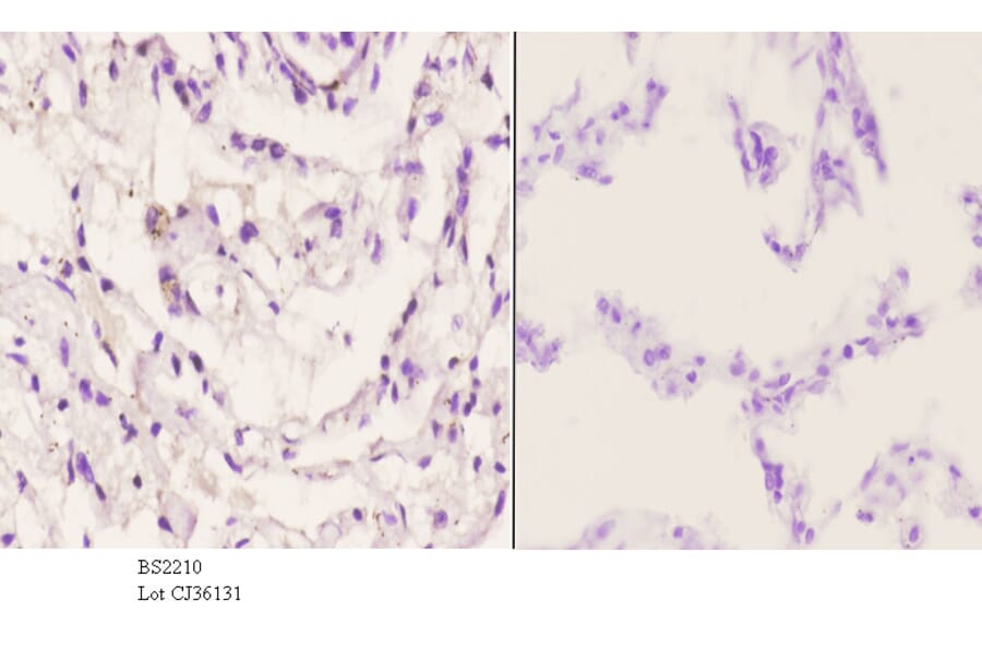 Anti-AR-β1 (A302) Antibody from Bioworld Technology (BS2210) - Antibodies.com
