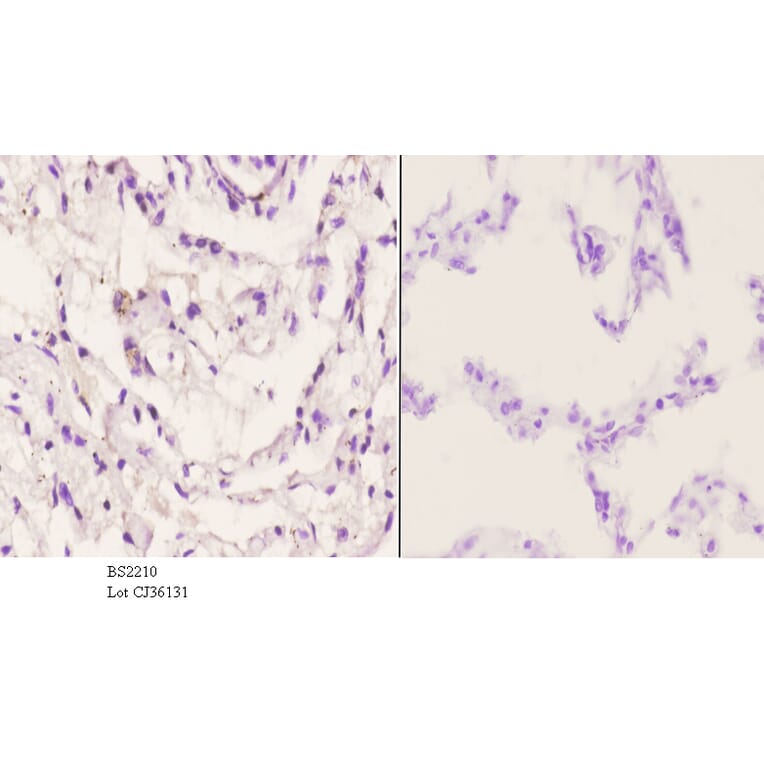 Anti-AR-β1 (A302) Antibody from Bioworld Technology (BS2210) - Antibodies.com