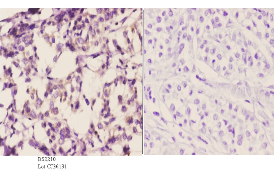 Anti-AR-β1 (A302) Antibody from Bioworld Technology (BS2210) - Antibodies.com