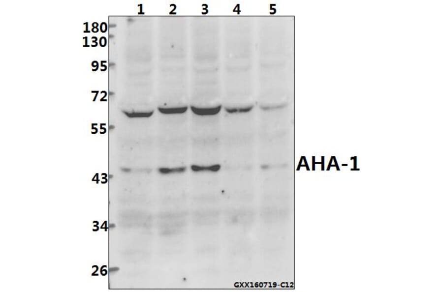 Anti-AHA-1 (T183) Antibody from Bioworld Technology (BS2211) - Antibodies.com