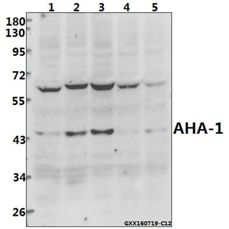Anti-AHA-1 (T183) Antibody from Bioworld Technology (BS2211) - Antibodies.com
