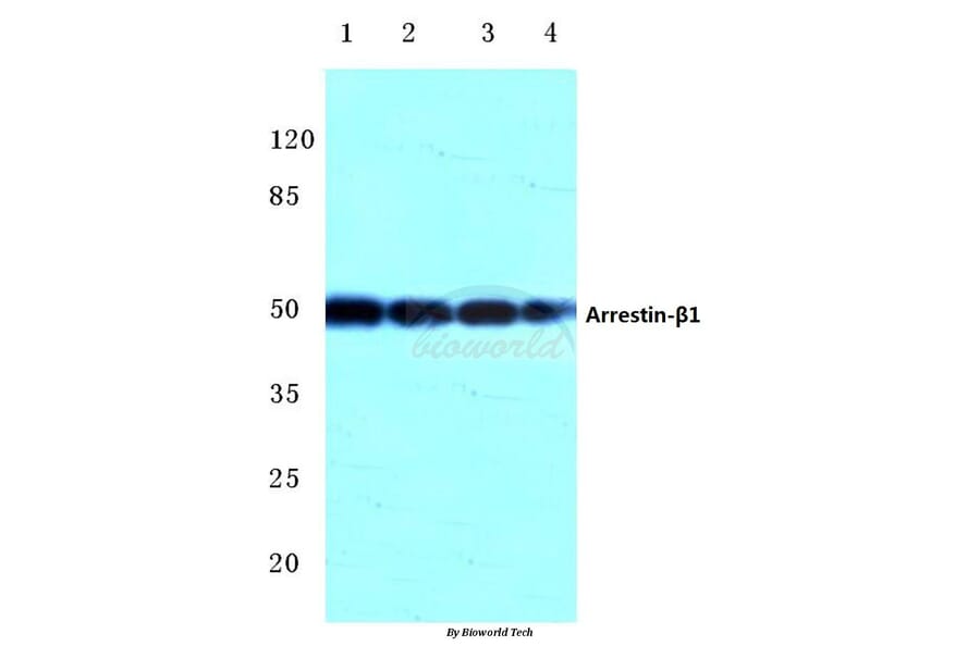 Anti-Arrestin-β-1 (Q394) Antibody from Bioworld Technology (BS2213) - Antibodies.com