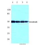 Anti-Arrestin-β-1 (Q394) Antibody from Bioworld Technology (BS2213) - Antibodies.com