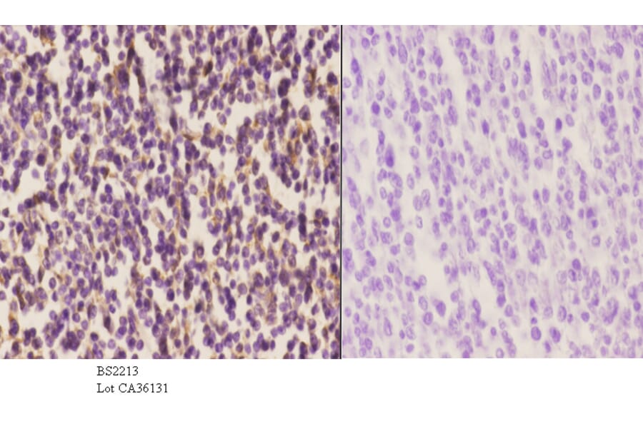 Anti-Arrestin-β-1 (Q394) Antibody from Bioworld Technology (BS2213) - Antibodies.com