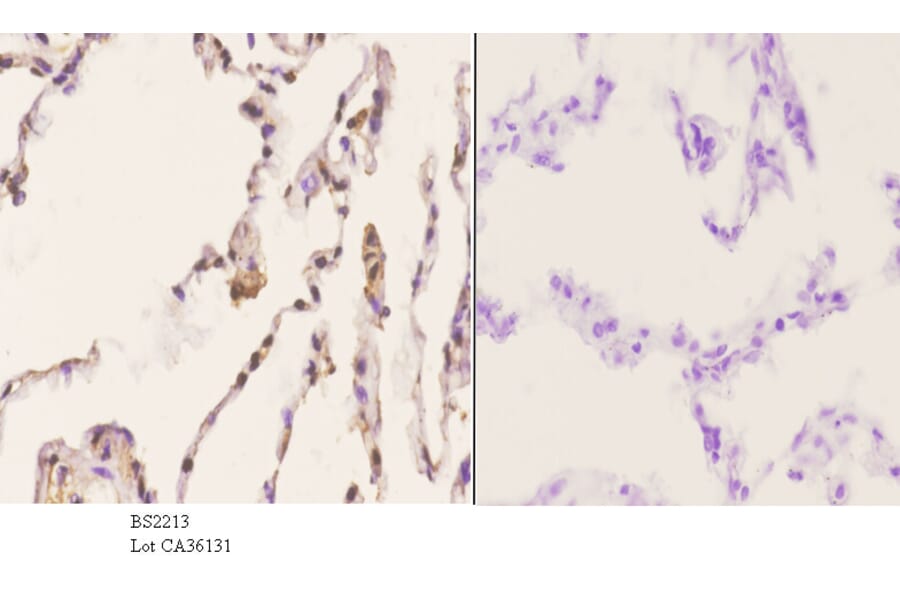 Anti-Arrestin-β-1 (Q394) Antibody from Bioworld Technology (BS2213) - Antibodies.com