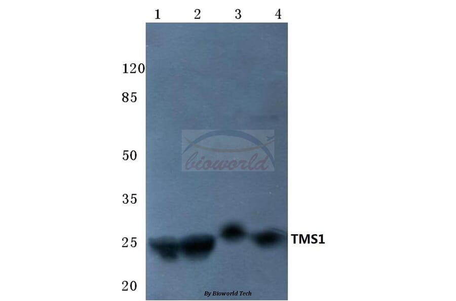 Anti-TMS1 (E13) Antibody from Bioworld Technology (BS2215) - Antibodies.com