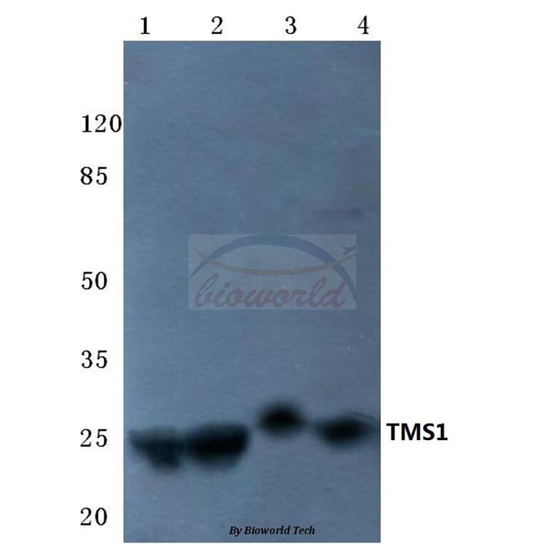 Anti-TMS1 (E13) Antibody from Bioworld Technology (BS2215) - Antibodies.com