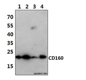 Anti-CD160 (T45) Antibody from Bioworld Technology (BS2217) - Antibodies.com