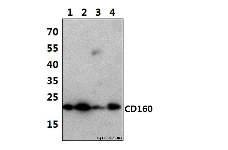 Anti-CD160 (T45) Antibody from Bioworld Technology (BS2217) - Antibodies.com