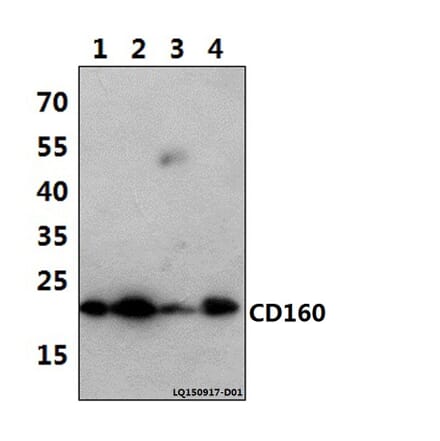 Anti-CD160 (T45) Antibody from Bioworld Technology (BS2217) - Antibodies.com