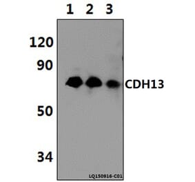 Anti-CDH13 (M352) Antibody from Bioworld Technology (BS2219) - Antibodies.com