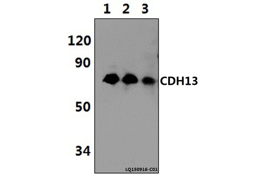 Anti-CDH13 (M352) Antibody from Bioworld Technology (BS2219) - Antibodies.com