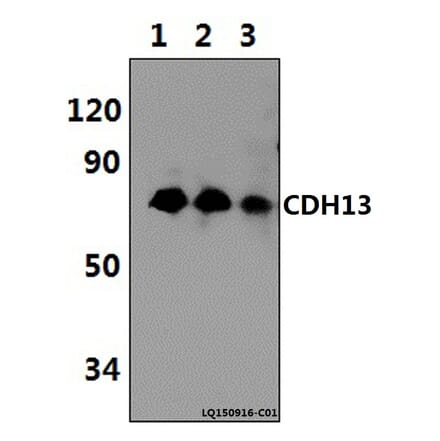 Anti-CDH13 (M352) Antibody from Bioworld Technology (BS2219) - Antibodies.com
