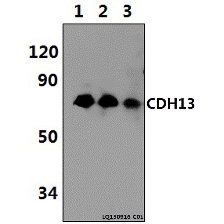 Anti-CDH13 (M352) Antibody from Bioworld Technology (BS2219) - Antibodies.com