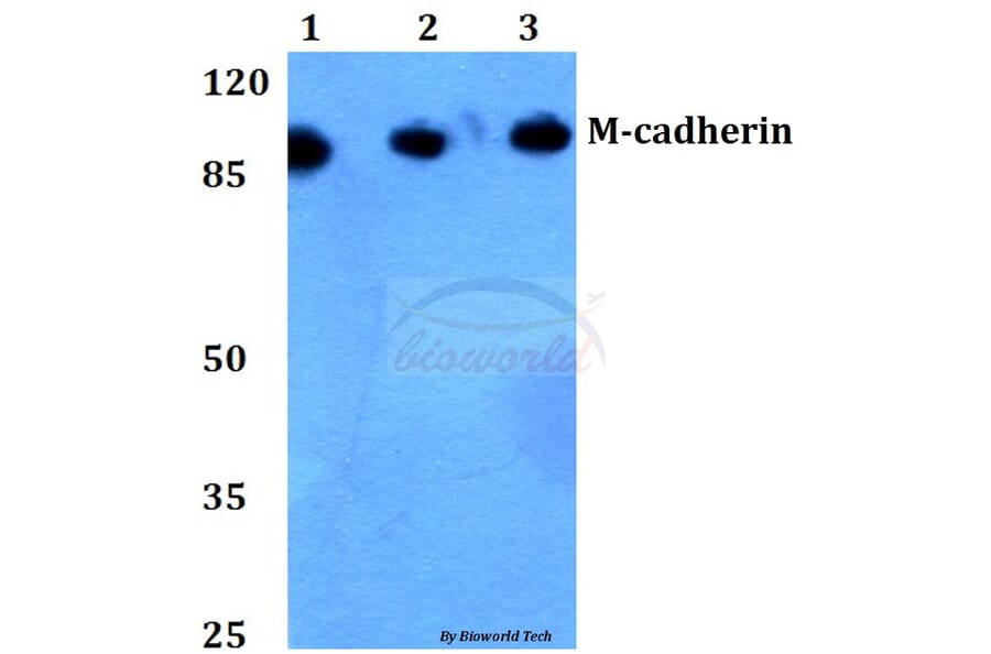 Anti-M-cadherin (A108) Antibody from Bioworld Technology (BS2220) - Antibodies.com