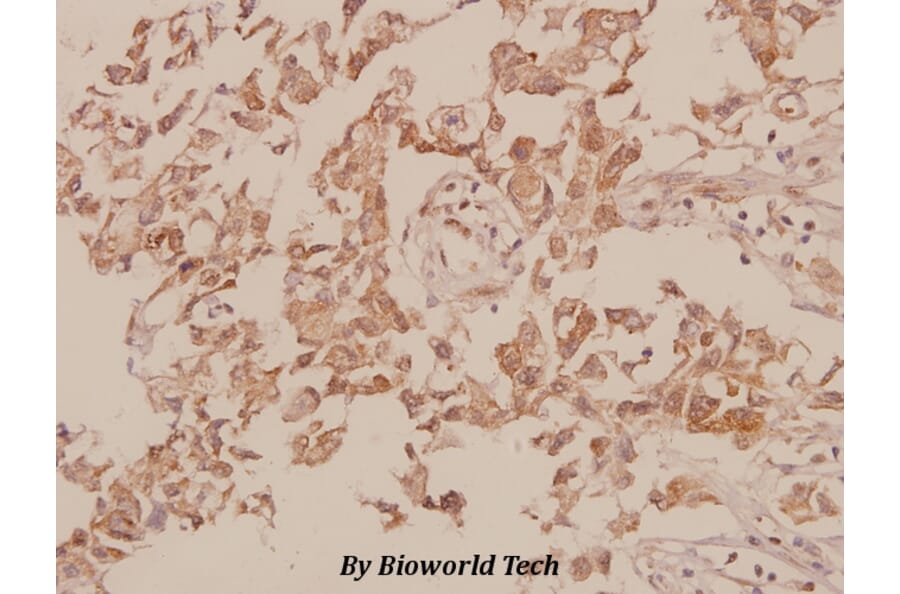 Anti-M-cadherin (A108) Antibody from Bioworld Technology (BS2220) - Antibodies.com