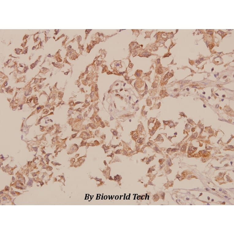 Anti-M-cadherin (A108) Antibody from Bioworld Technology (BS2220) - Antibodies.com