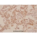 Anti-M-cadherin (A108) Antibody from Bioworld Technology (BS2220) - Antibodies.com
