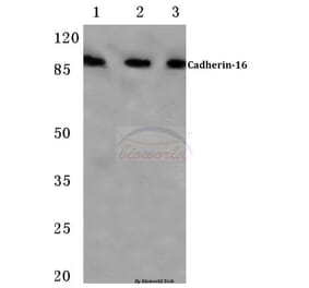 Anti-Cadherin-16 (M810) Antibody from Bioworld Technology (BS2221) - Antibodies.com