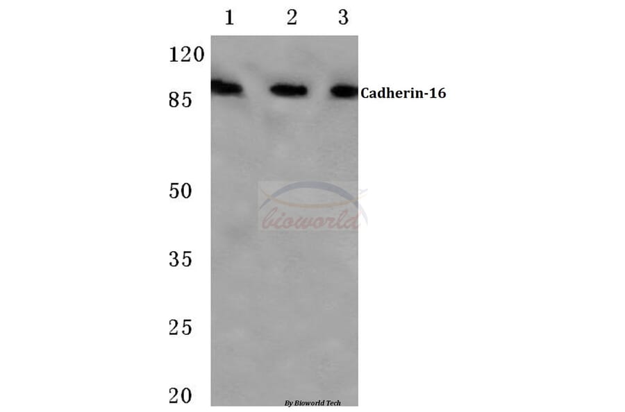 Anti-Cadherin-16 (M810) Antibody from Bioworld Technology (BS2221) - Antibodies.com