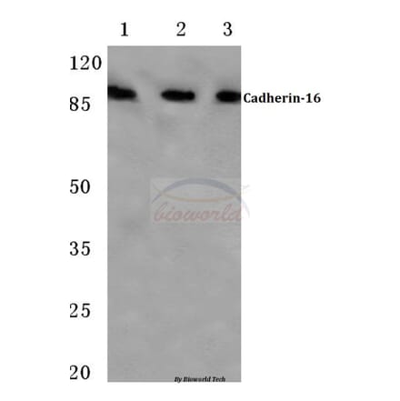 Anti-Cadherin-16 (M810) Antibody from Bioworld Technology (BS2221) - Antibodies.com
