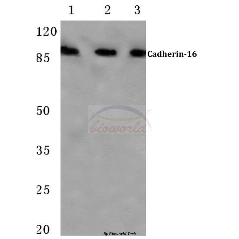Anti-Cadherin-16 (M810) Antibody from Bioworld Technology (BS2221) - Antibodies.com