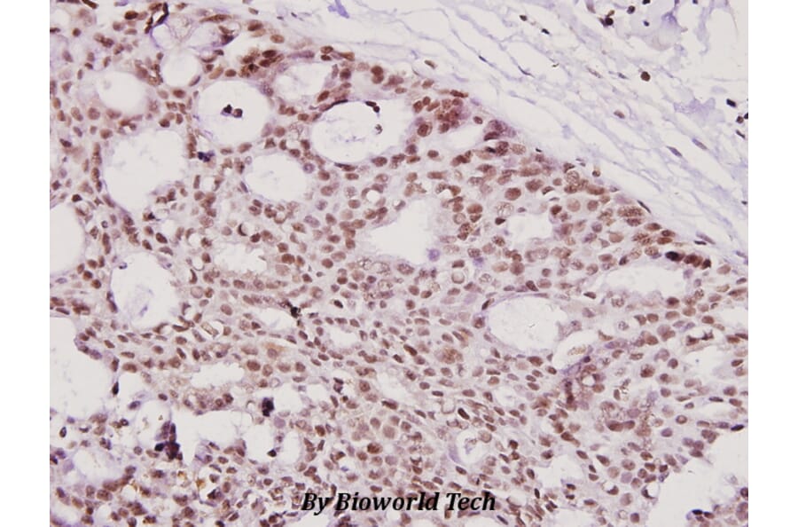 Anti-ICAD (Q177) Antibody from Bioworld Technology (BS2229) - Antibodies.com