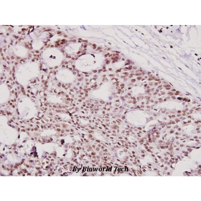 Anti-ICAD (Q177) Antibody from Bioworld Technology (BS2229) - Antibodies.com