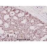 Anti-ICAD (Q177) Antibody from Bioworld Technology (BS2229) - Antibodies.com