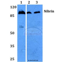 Anti-Nibrin (P461) Antibody from Bioworld Technology (BS2230) - Antibodies.com