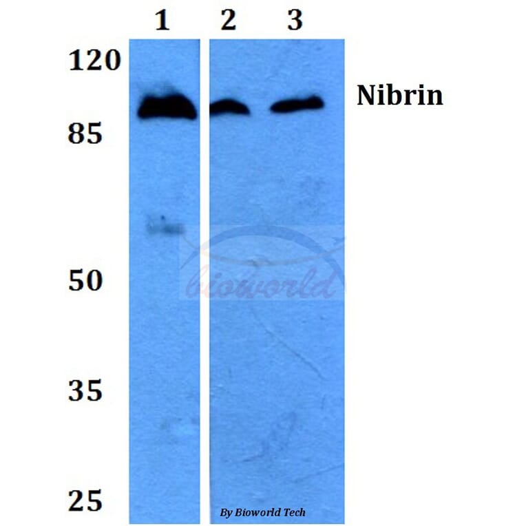 Anti-Nibrin (P461) Antibody from Bioworld Technology (BS2230) - Antibodies.com