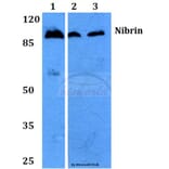 Anti-Nibrin (P461) Antibody from Bioworld Technology (BS2230) - Antibodies.com