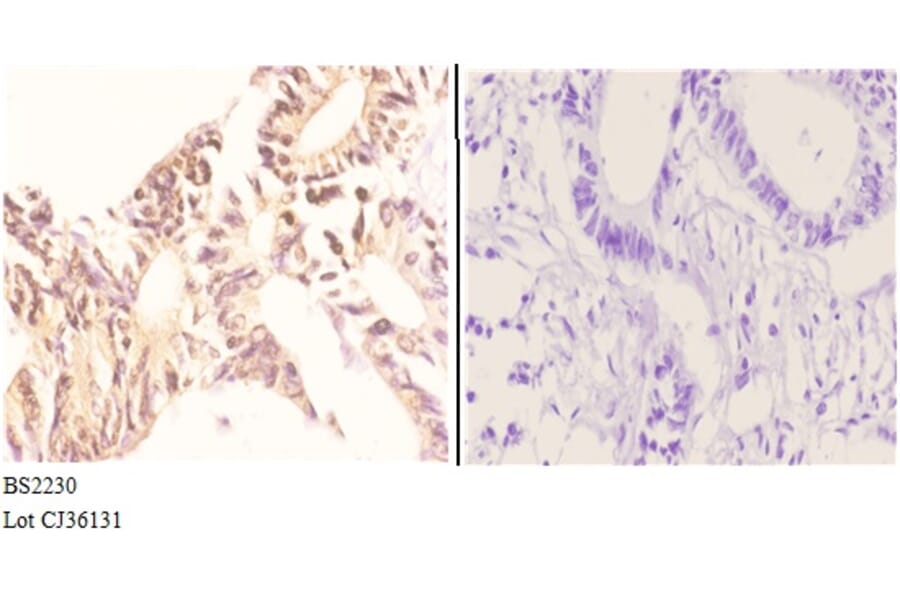 Anti-Nibrin (P461) Antibody from Bioworld Technology (BS2230) - Antibodies.com