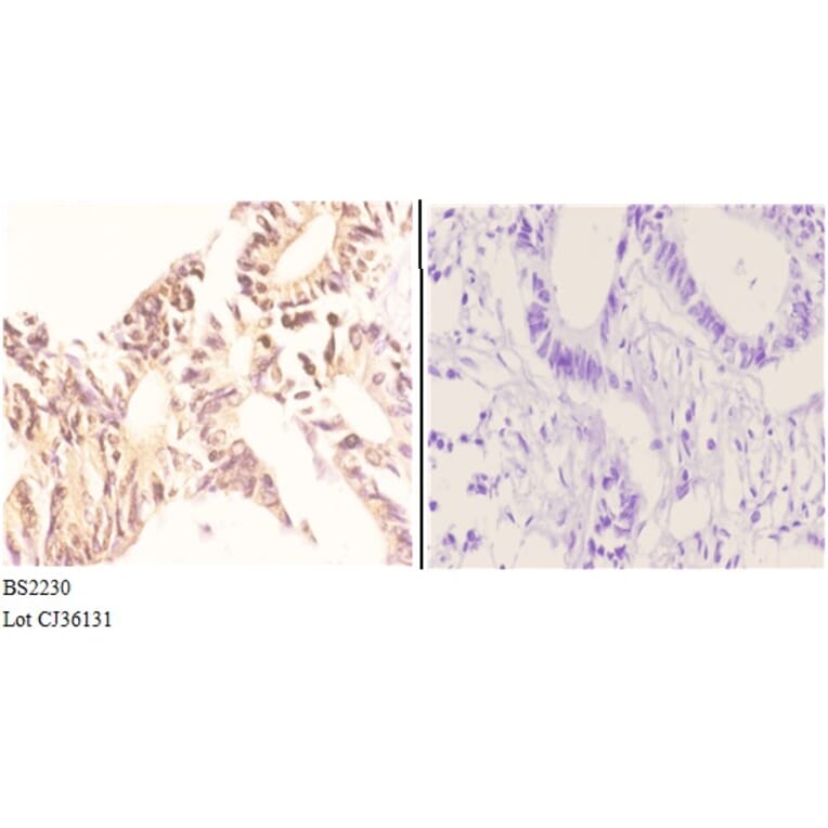 Anti-Nibrin (P461) Antibody from Bioworld Technology (BS2230) - Antibodies.com