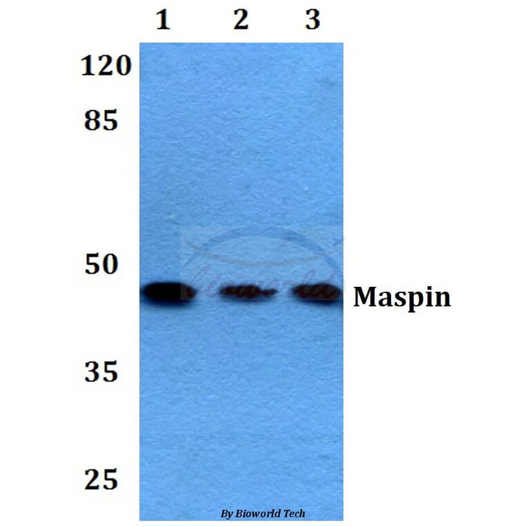 Anti-Maspin (T118) Antibody from Bioworld Technology (BS2233) - Antibodies.com