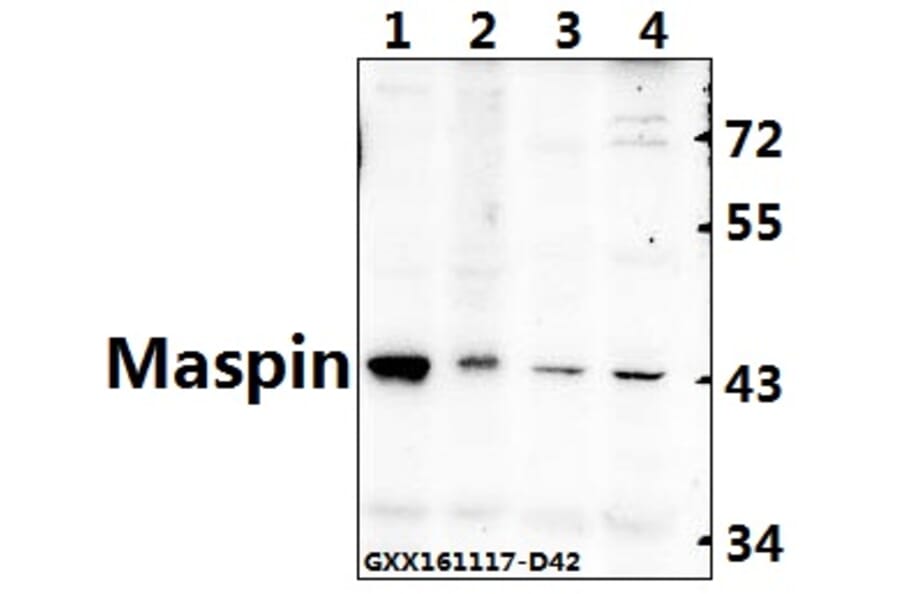 Anti-Maspin (T118) Antibody from Bioworld Technology (BS2233) - Antibodies.com