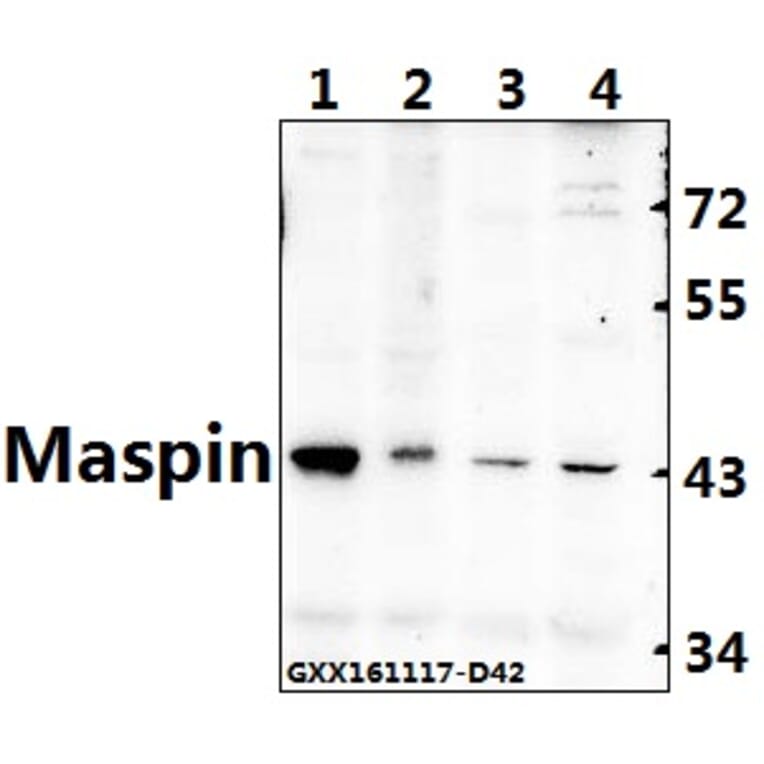 Anti-Maspin (T118) Antibody from Bioworld Technology (BS2233) - Antibodies.com