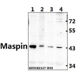 Anti-Maspin (T118) Antibody from Bioworld Technology (BS2233) - Antibodies.com