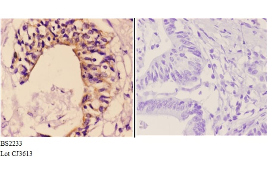 Anti-Maspin (T118) Antibody from Bioworld Technology (BS2233) - Antibodies.com